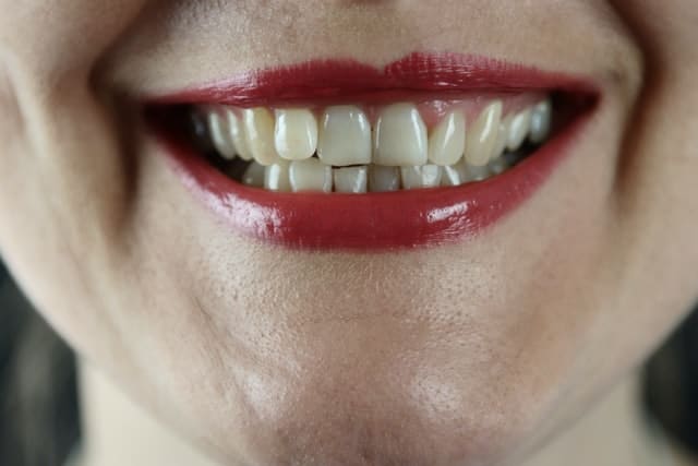 Få tilskud til en tandprotese eller tandimplantat som pensionist i Nordsjælland